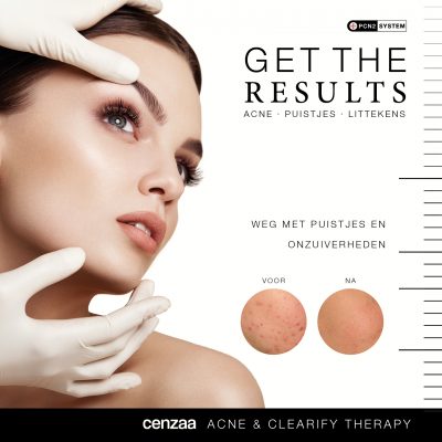 CENZAA ACNE CLEARIFY THERAPY